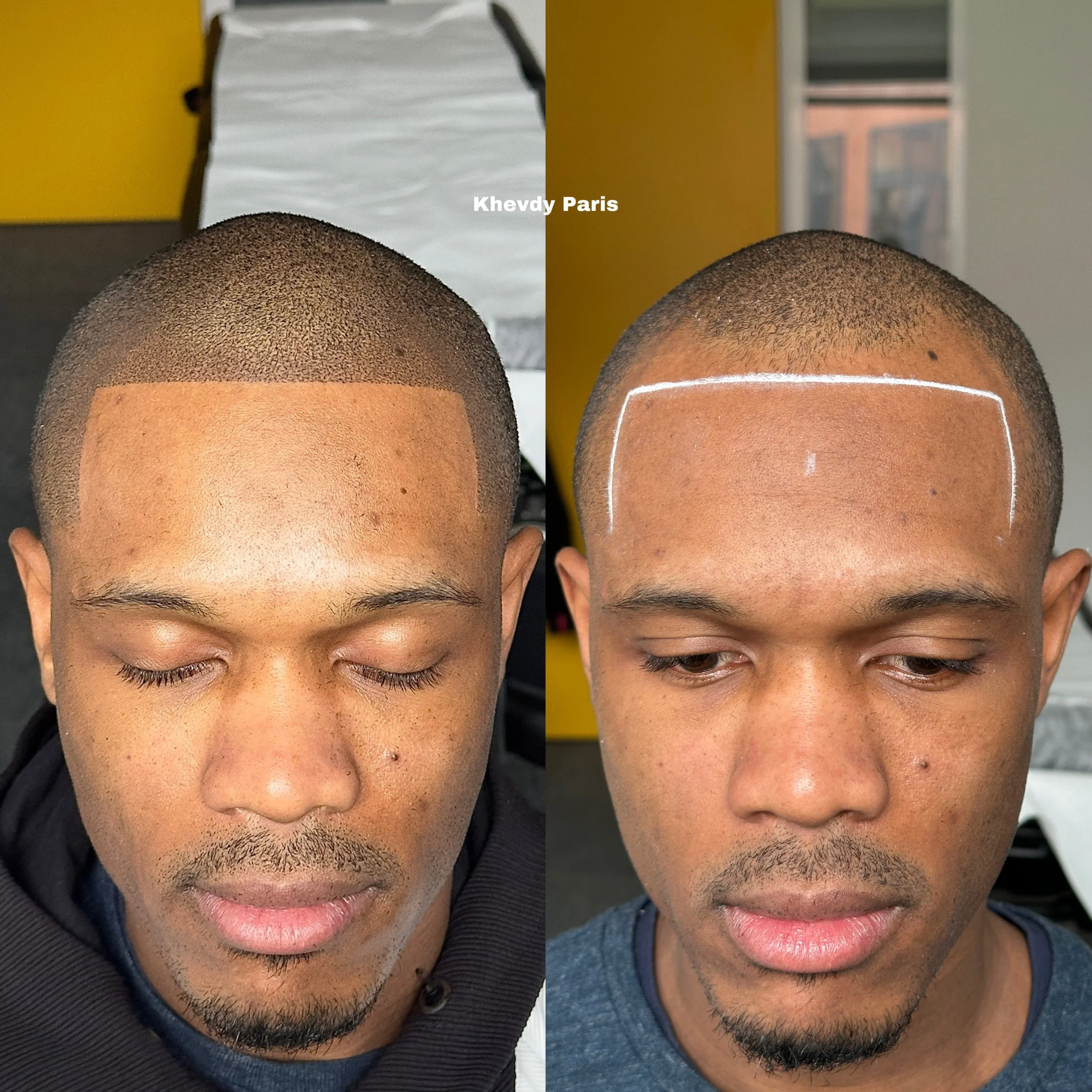 Contours : Restaurer vos contours sur mesure, finition naturelle. Redéfinition précise des contours avec une zone frontale bien tracée ou brute. Un travail minutieux pour un résultat 100 % personnalisé, parfaitement adapté à votre morphologie et à vo