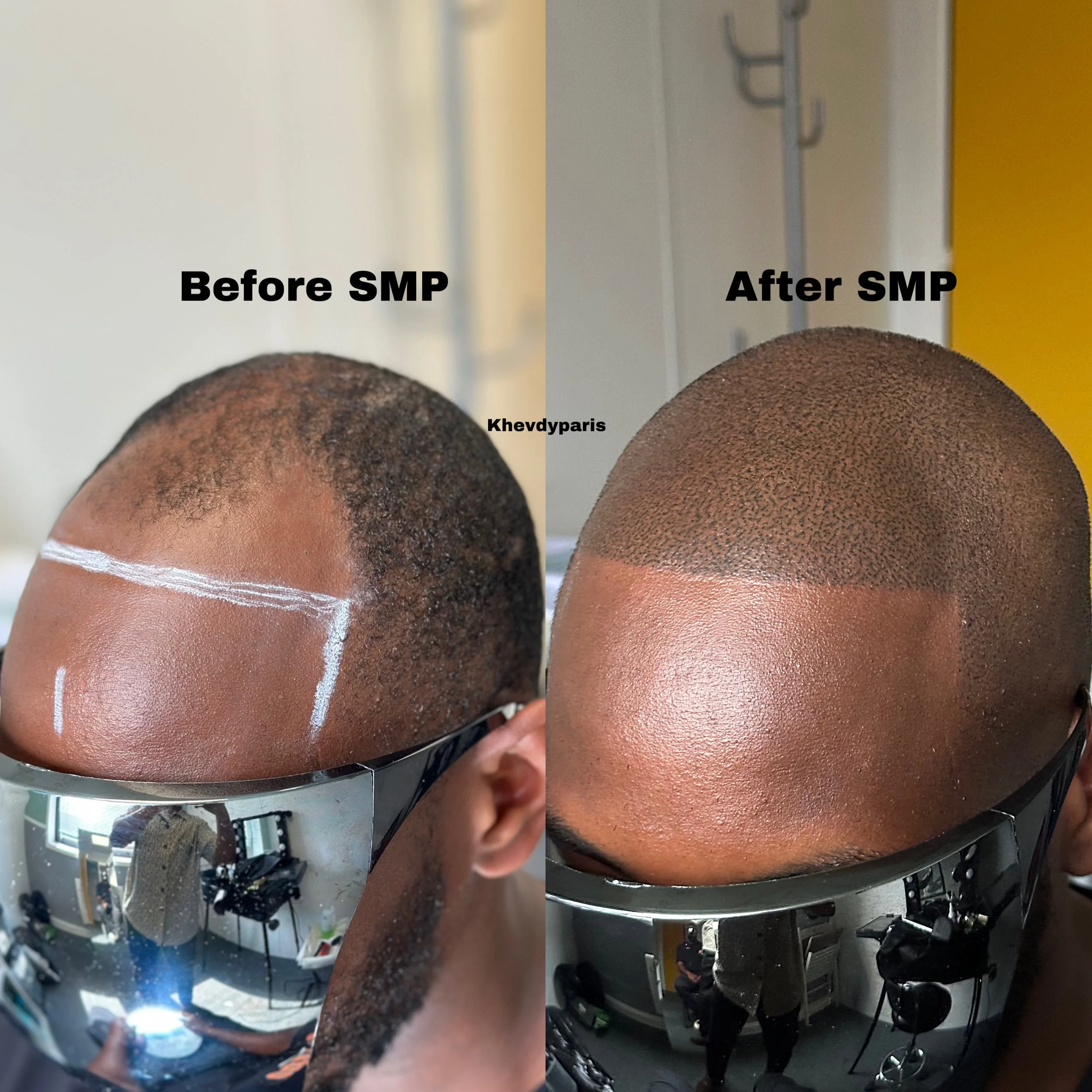 SMP avant/après effet rasé au style américain ! travail personnalisé pour notre client venu de loin pour faire à la qualité de notre service