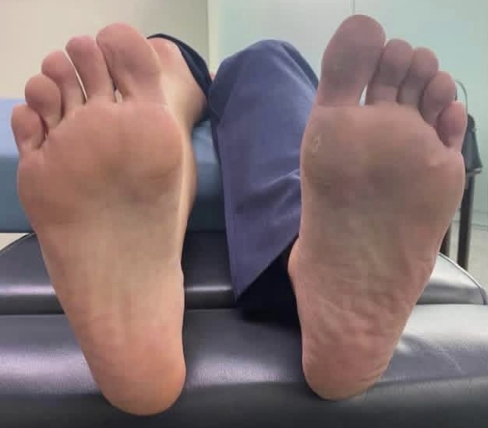 Close-up of the soles of two feet with toes spread, resting on a surface, with a person in a hospital or clinical setting in the background.