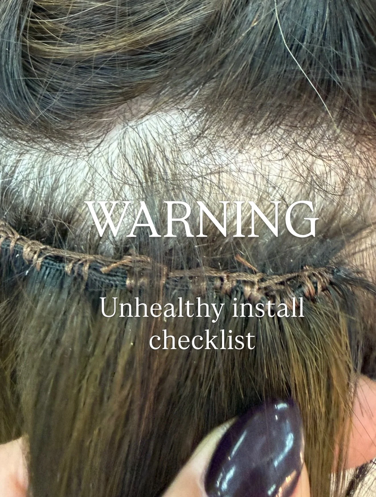 This new guest visit had me frustrated&hellip; again.

A respected salon and licensed extension artist left this guest with traction alopecia and potential long-term damage.

And it was clear this didn&rsquo;t happen in one appointment, it happened o