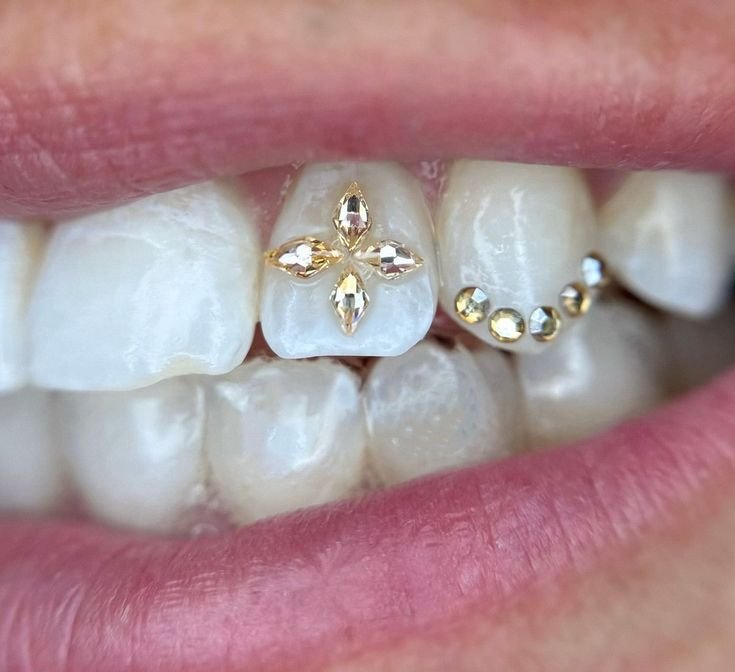 Close-up of a person's mouth showing teeth with decorative gold and gemstone dental jewelry on the front tooth and a small row of gemstones on the adjacent tooth.