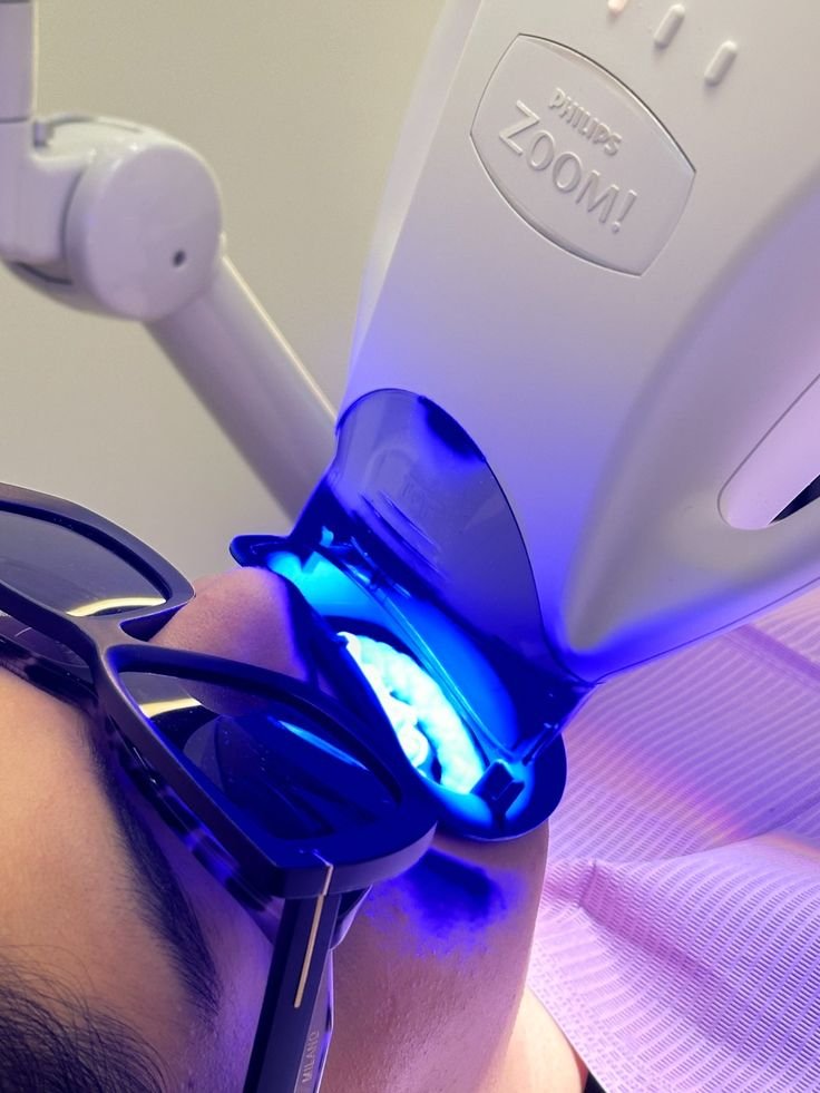 Close-up of a person's face undergoing a dental procedure using a purple dental curing light. The dentist's glasses are visible, and the patient is wearing protective glasses.