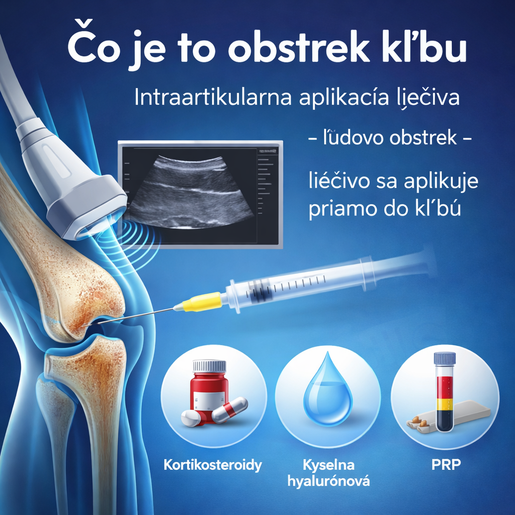 Obstrek kĺbu: Všetko, čo by ste mali vedieť pred intraartikulárnou aplikáciou liečiv