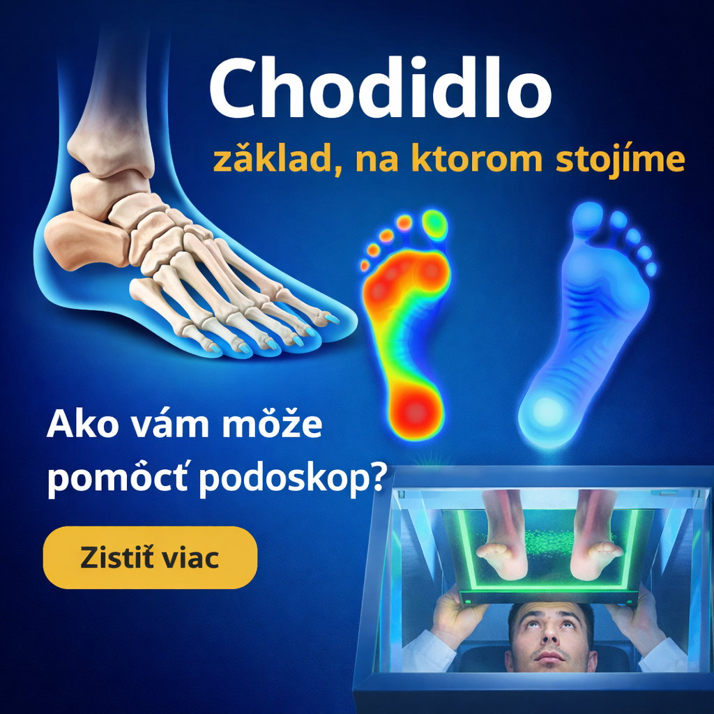 Podoskop a ploché nohy: Prečo je zdravé chodidlo základom celého pohybového aparátu