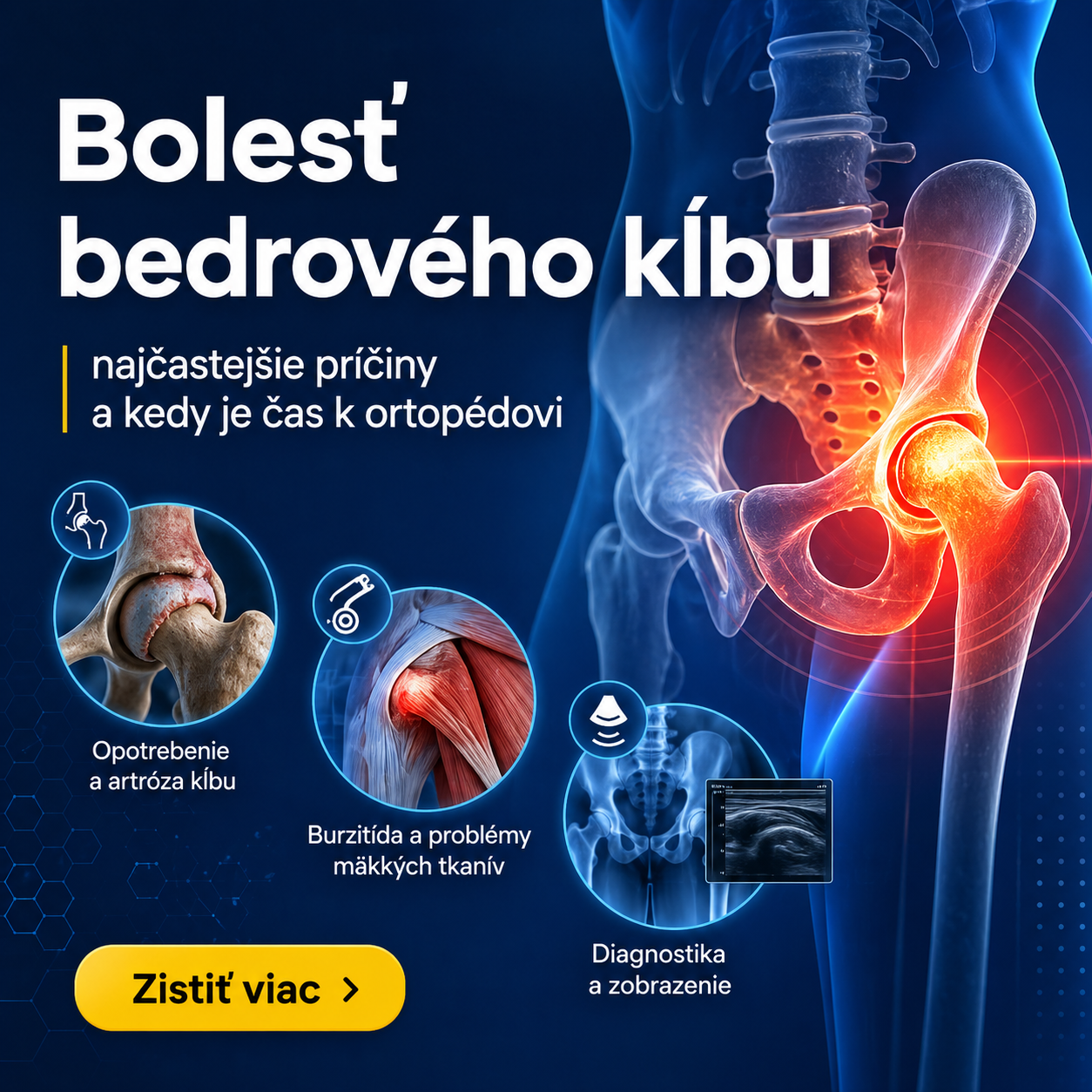 Bolesť bedrového kĺbu: najčastejšie príčiny a kedy je čas k ortopédovi
