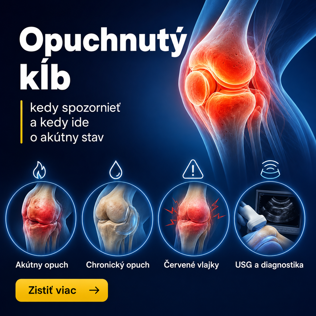 Opuchnutý kĺb: kedy spozornieť a kedy ide o akútny stav