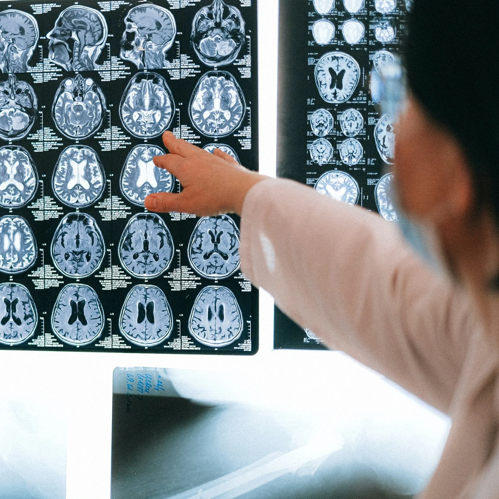 Stress Literally Changes Our Brain’s Built Environment