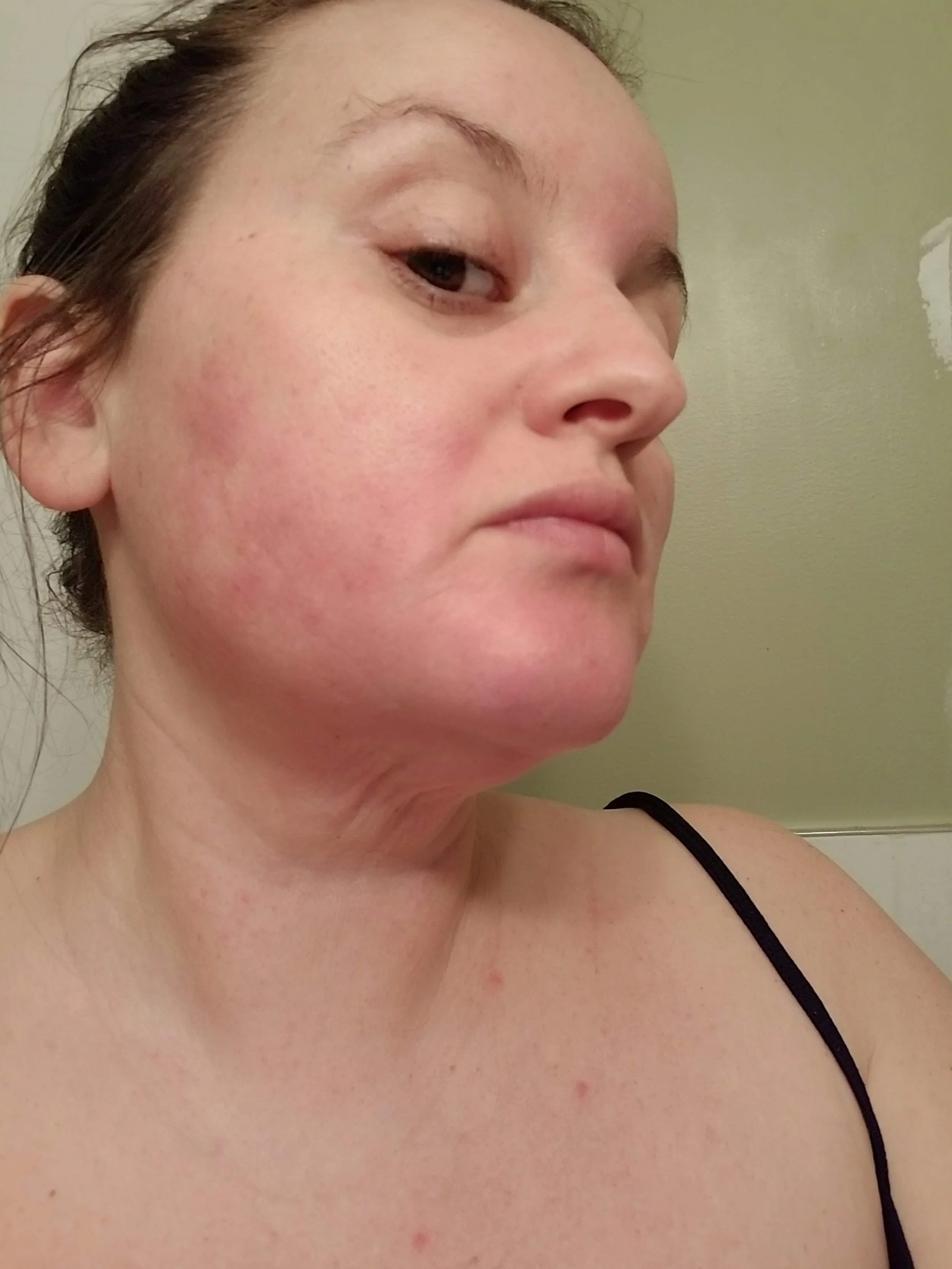 Jaymee Face skin Flare 2.jpg