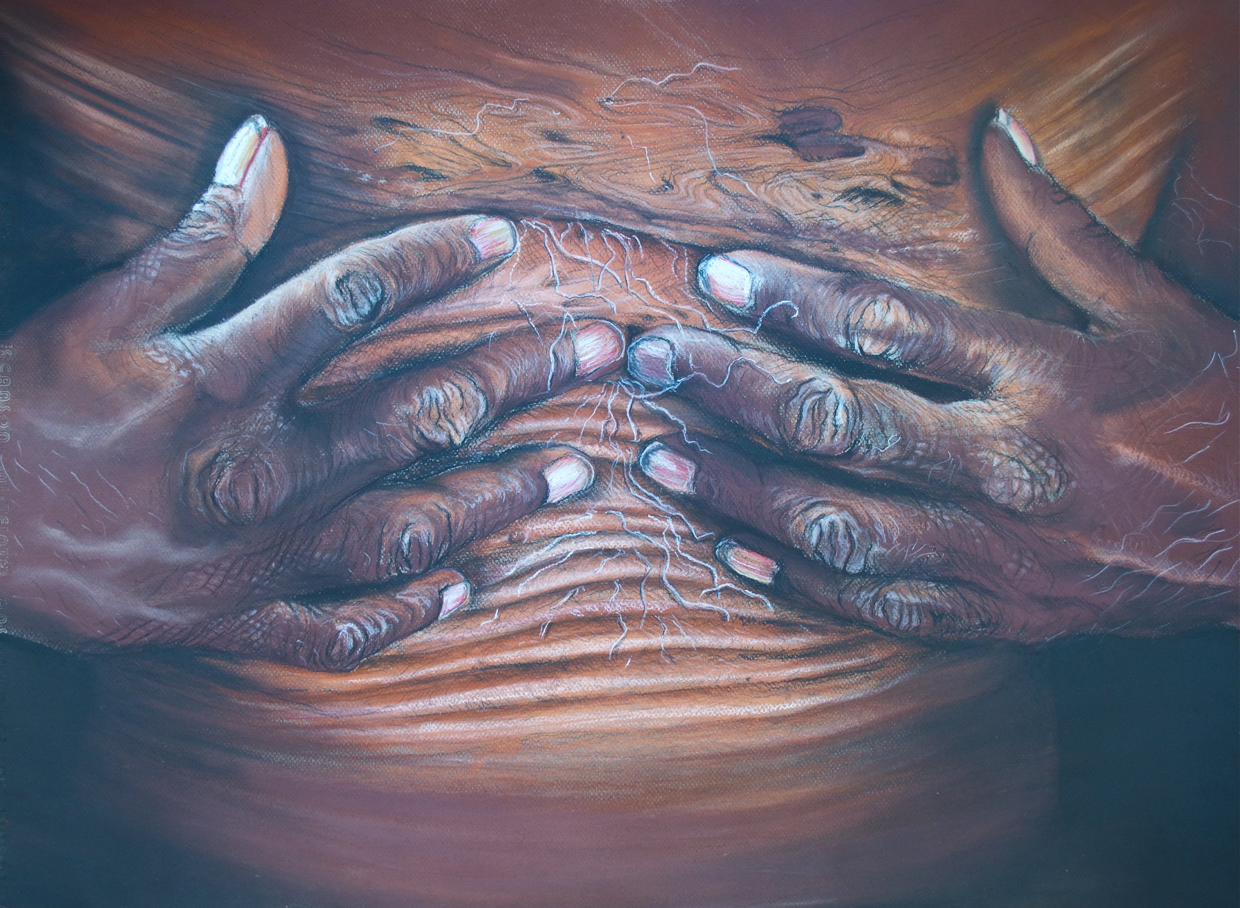 Close-up of a person's hands pressing on their stomach area, highlighting skin texture and veins.