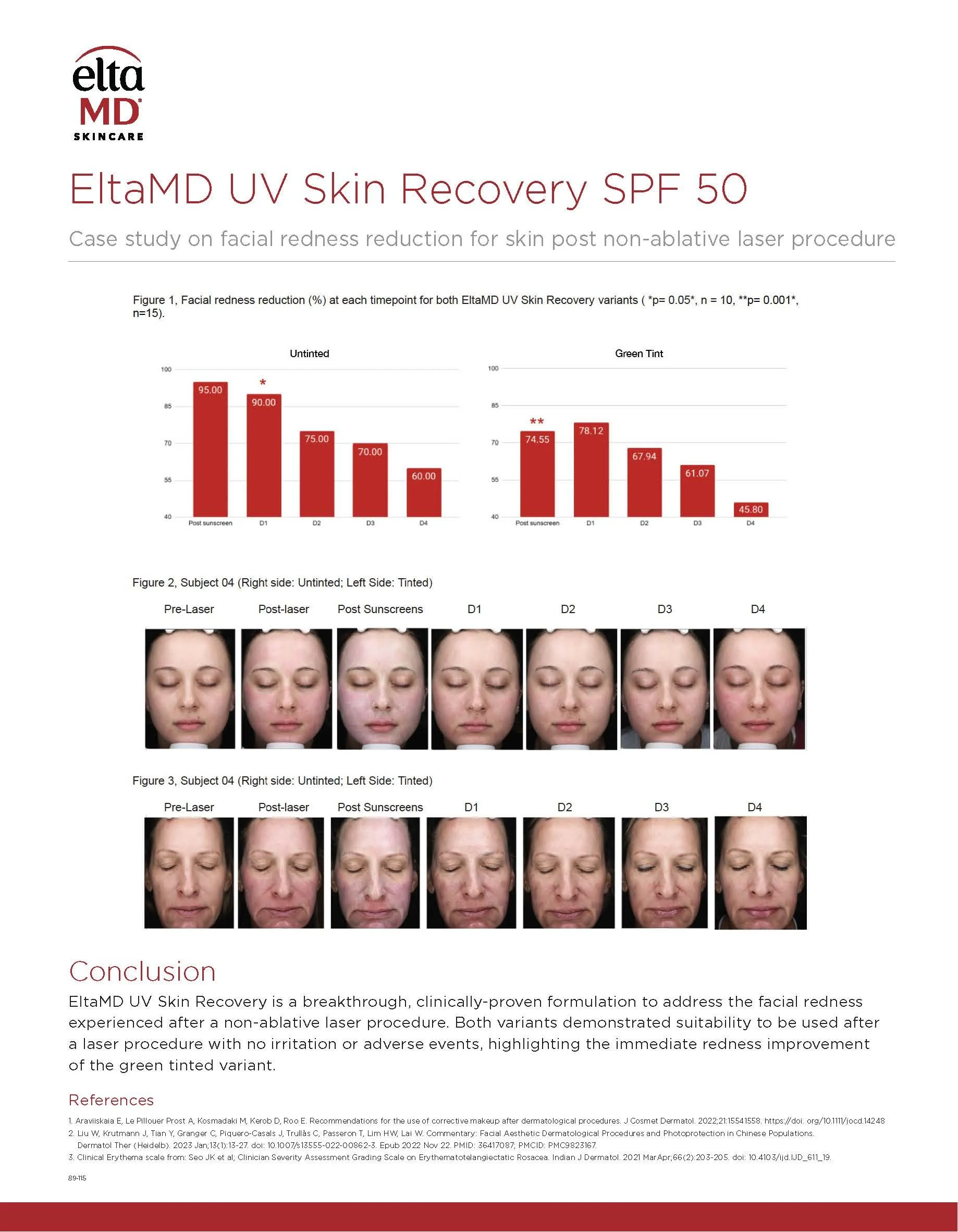 UVSkinRecovery_WhitePaper_Page_2.jpg