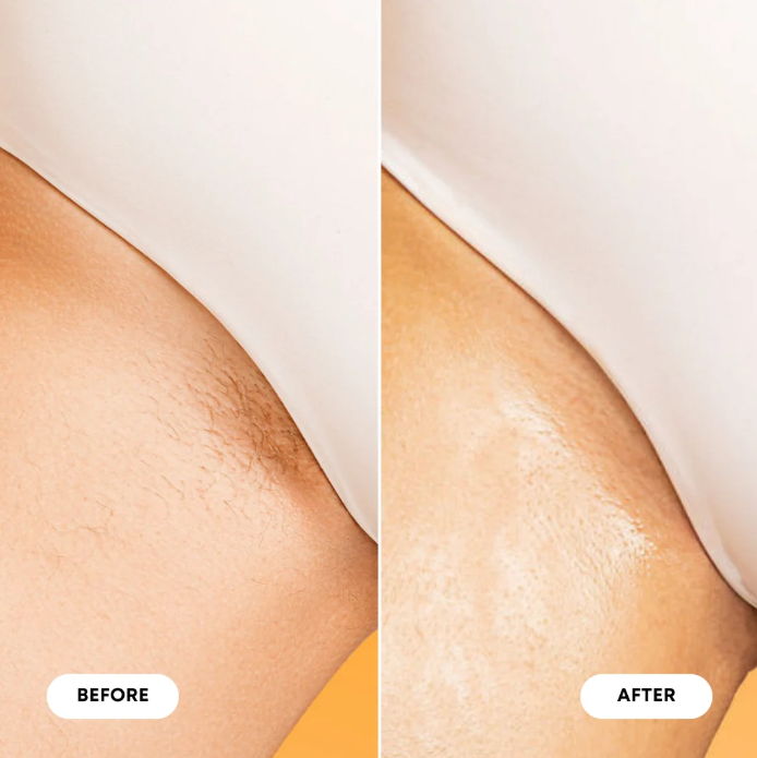 SJ Before and After.png