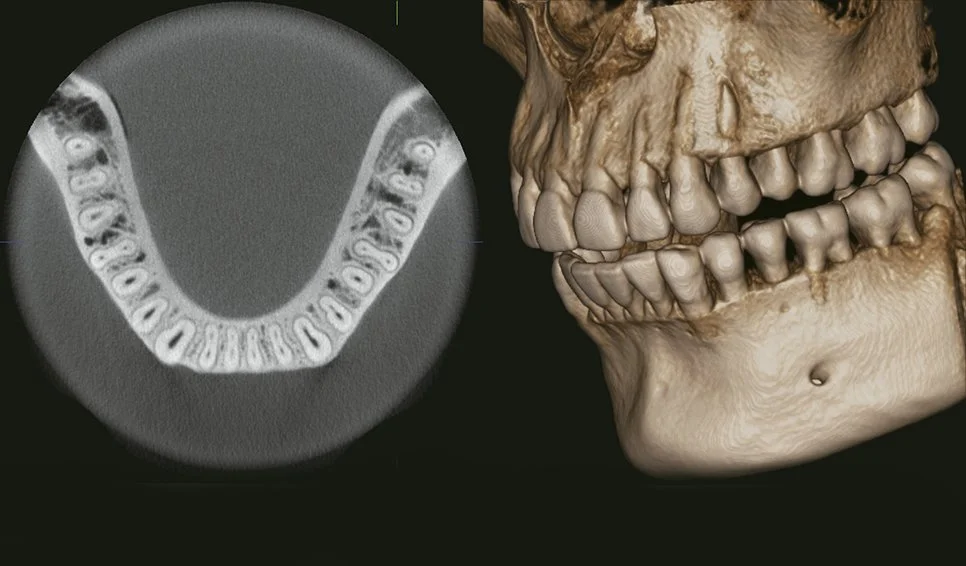 Tomografía Multidental.jpg