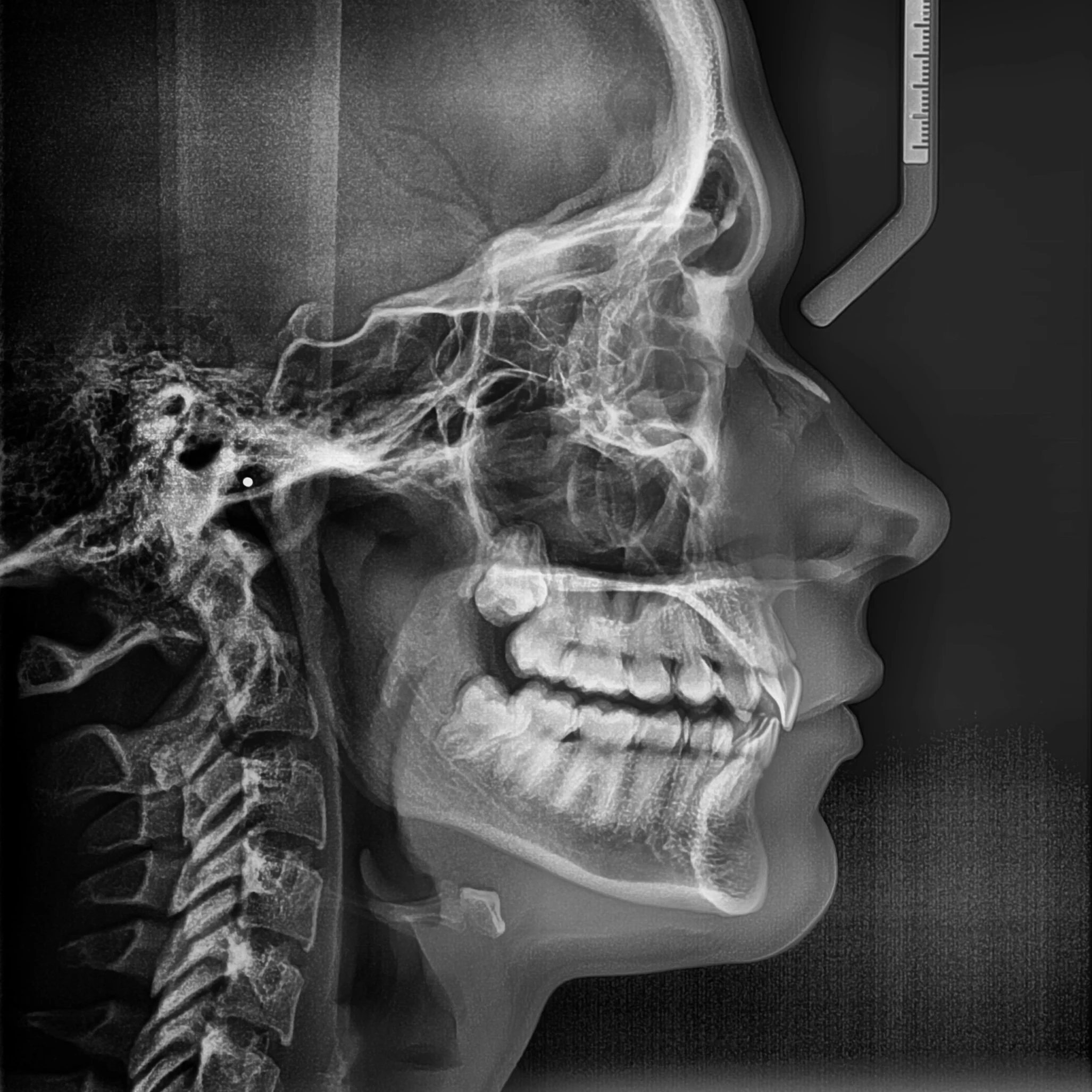 radiografia lateral de craneo.jpg