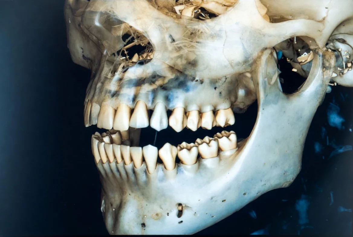 Tomografía de Maxilares .jpg