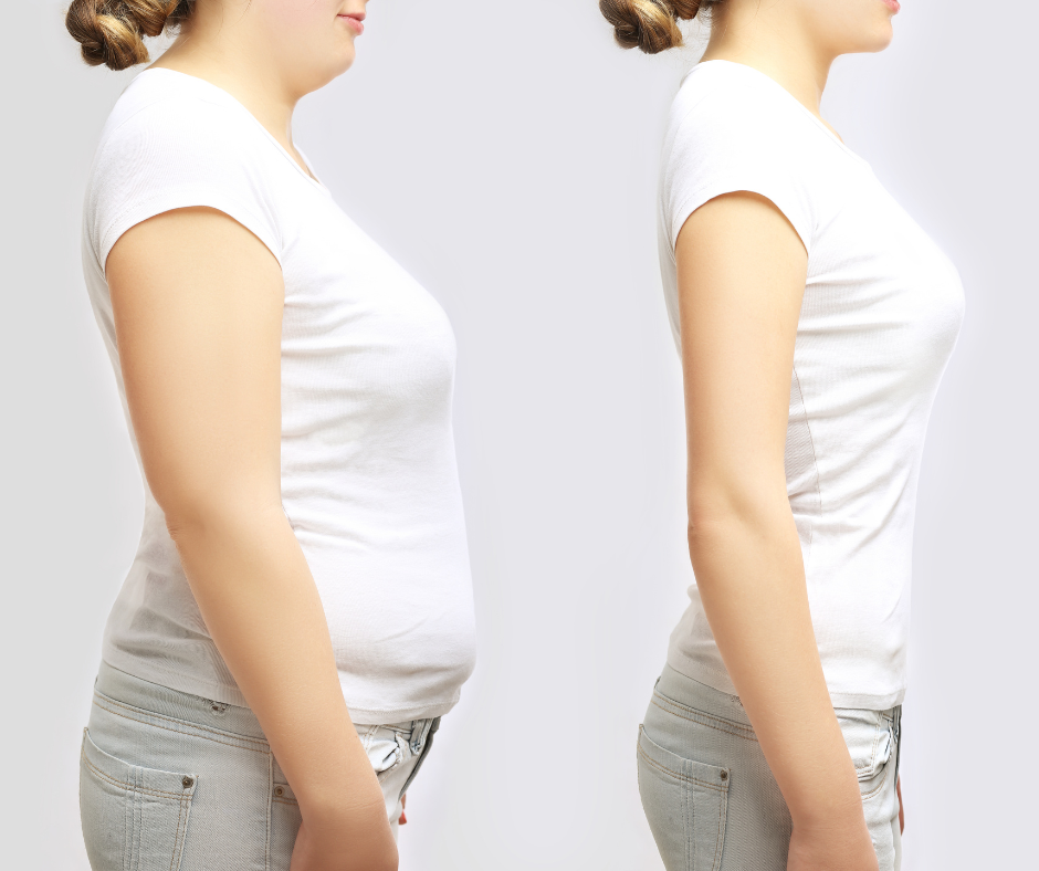 GLP-1 Weight Loss Injections