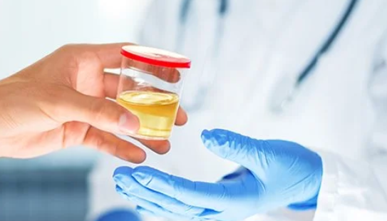 (Mobile) NON- Dot Collection