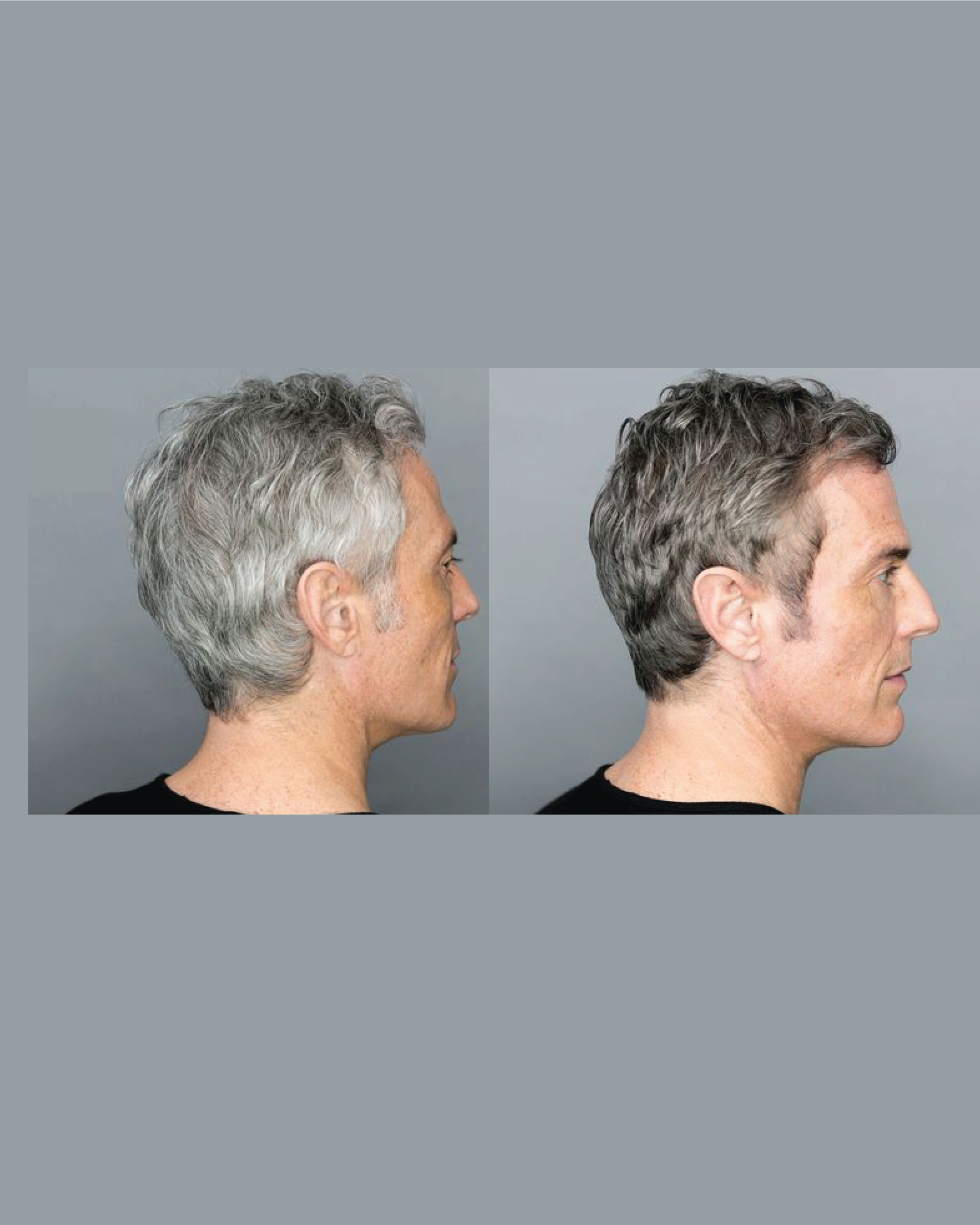 Before and after grey blending on men’s hair