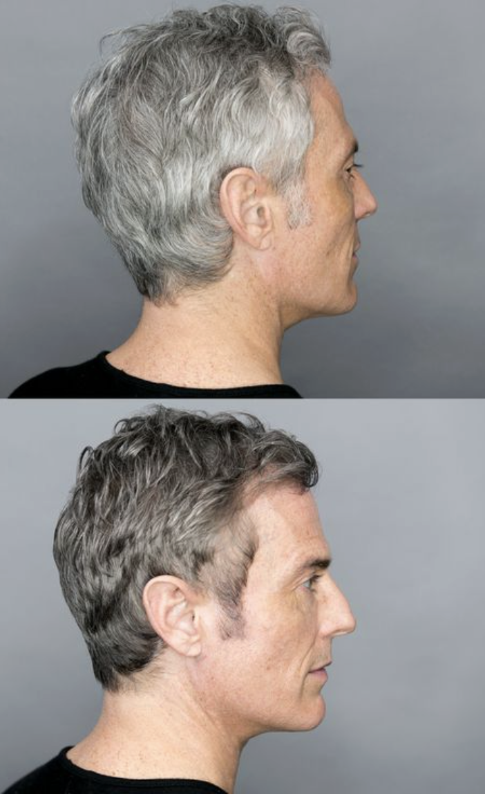 Side-by-side comparison of a woman with gray hair before and after a hair transformation, showing fuller, styled hair after treatment.