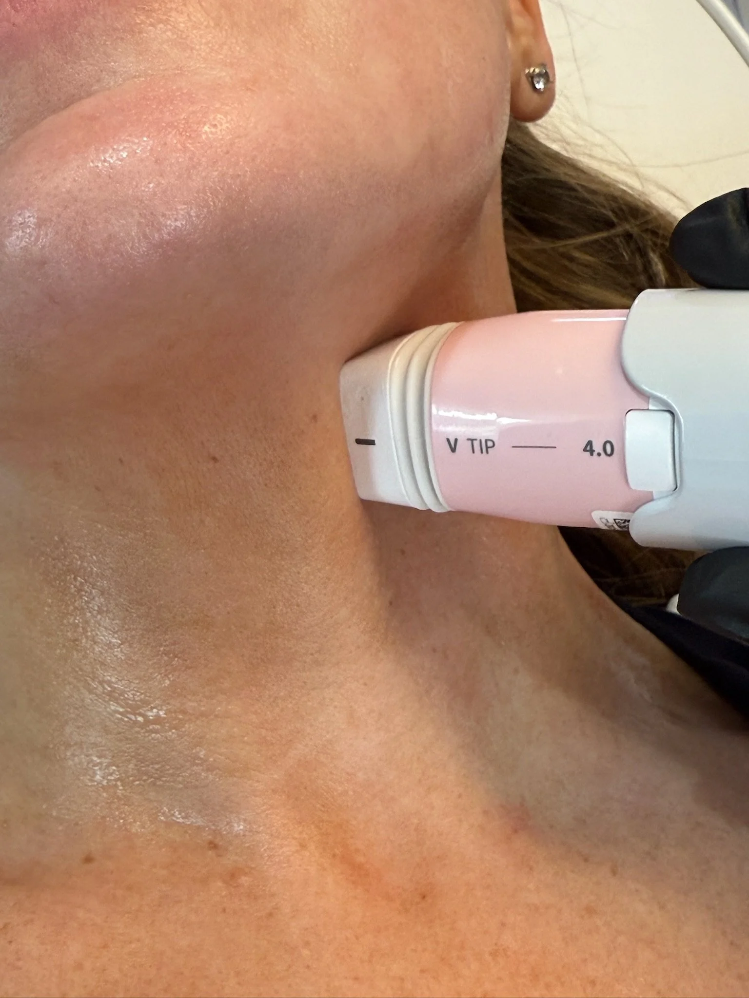 A medical procedure involving an ultrasound probe placed on the person's neck.