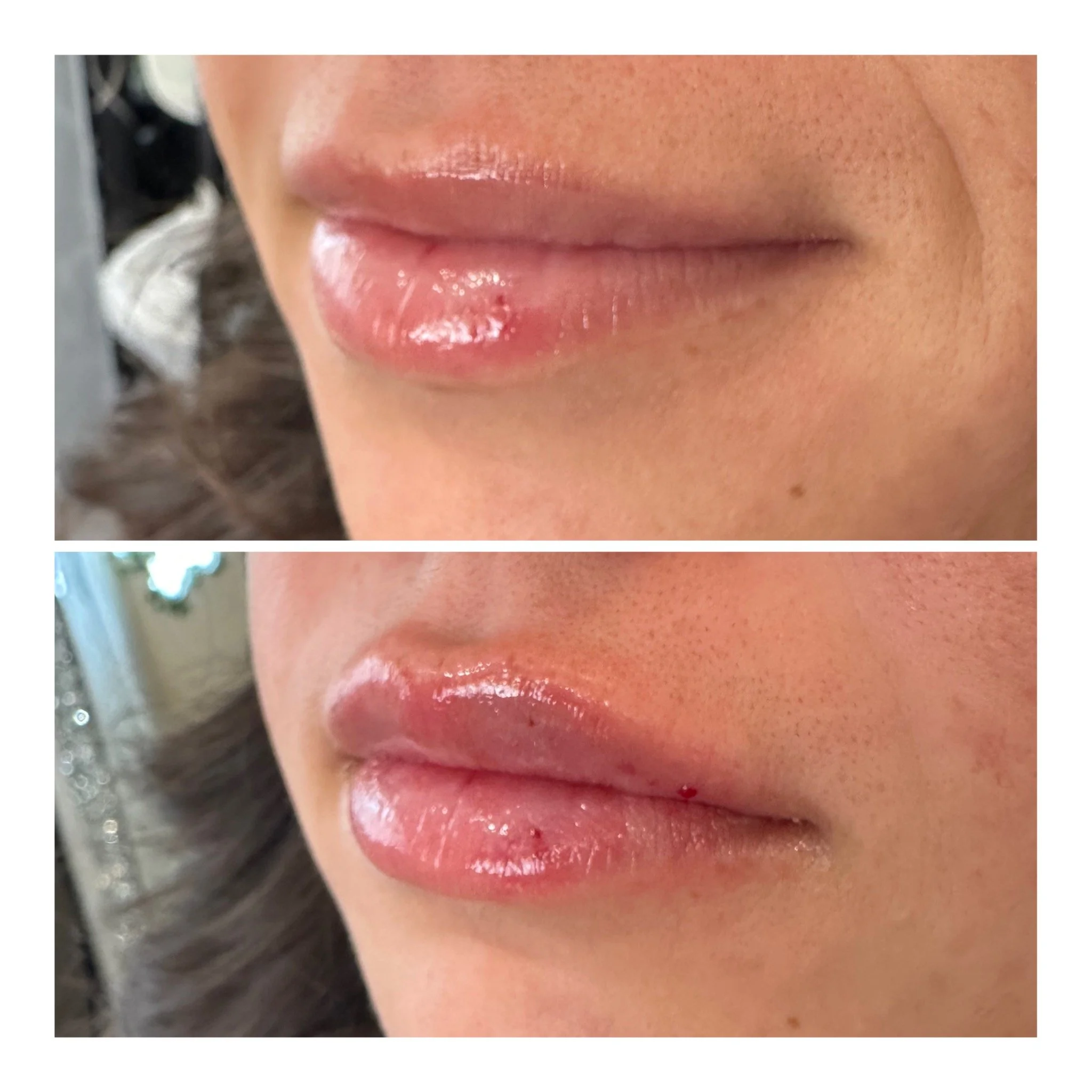 Close-up of a person's lips, showing before and after where lips appear more plump and glossy in the second image.