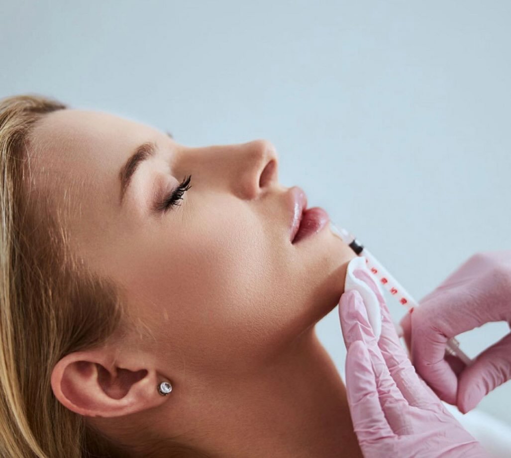 #filler#lipfillers#facefillers#botox#facial&rsquo;s esthetician