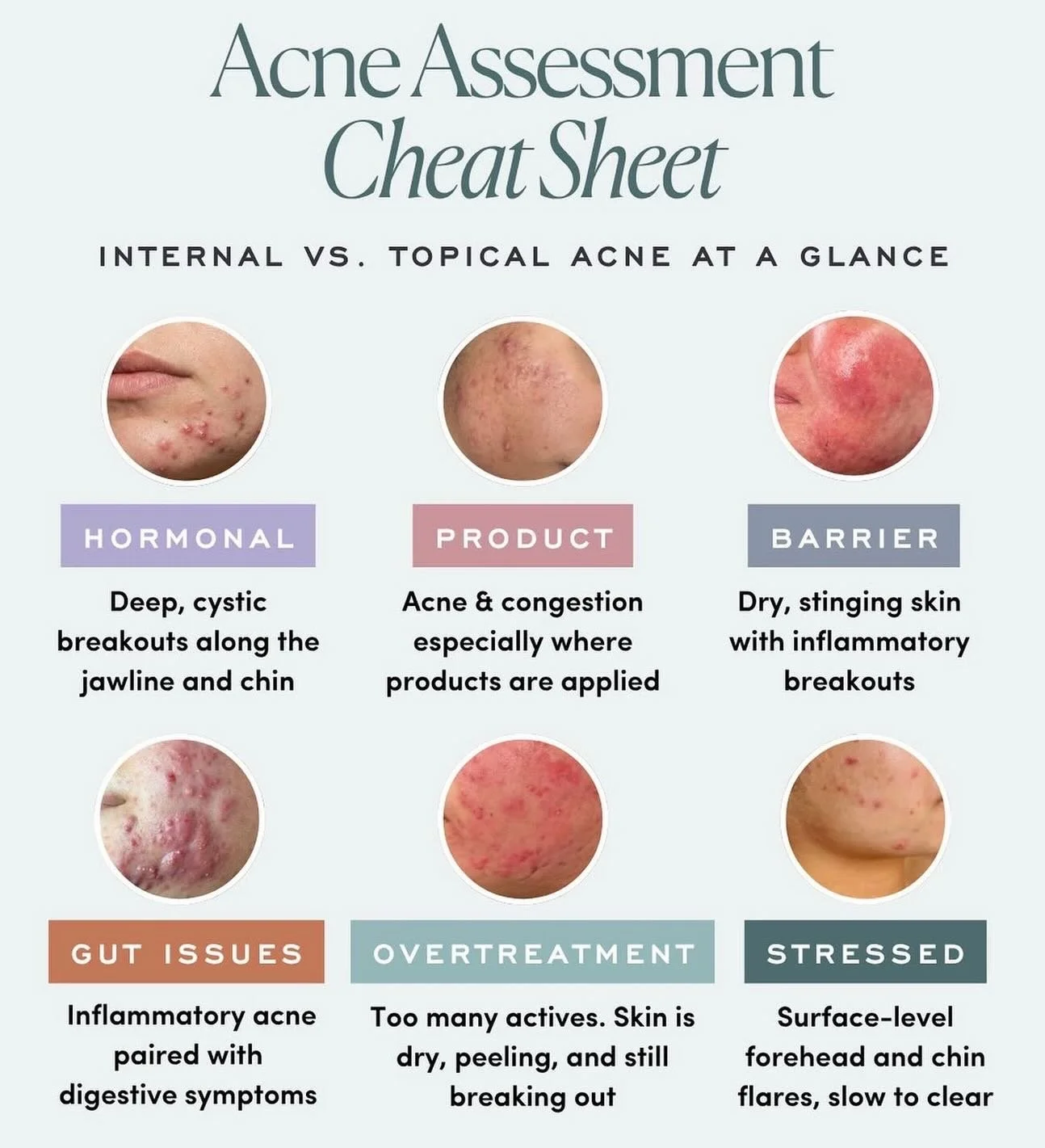 Acne isn&rsquo;t random ✨
Learn what your breakouts are telling you with this cheat sheet.
Save for later 🤍
#AcneTips #SkinCare #ClearSkinJourney#michellewestbeauty
