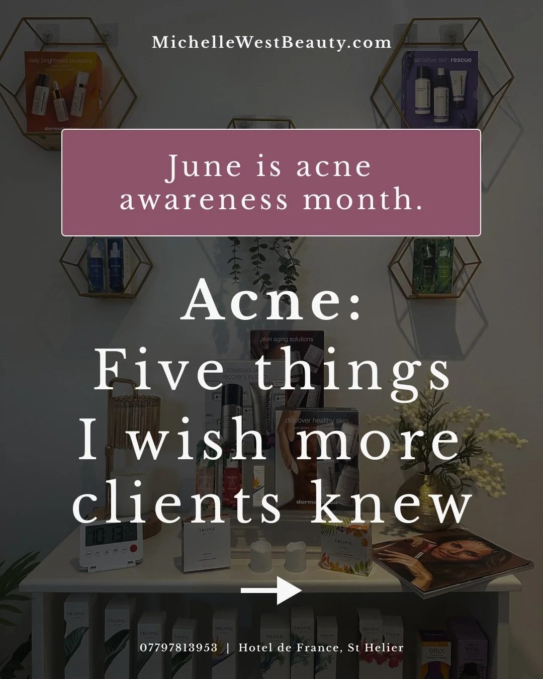 June is Acne Awareness Month.

26 years in the treatment room and I still hear the same things about acne.

So here are five I&rsquo;d love everyone to stop believing. Adult acne is far more common than people realise, your skin isn&rsquo;t &ldquo;di