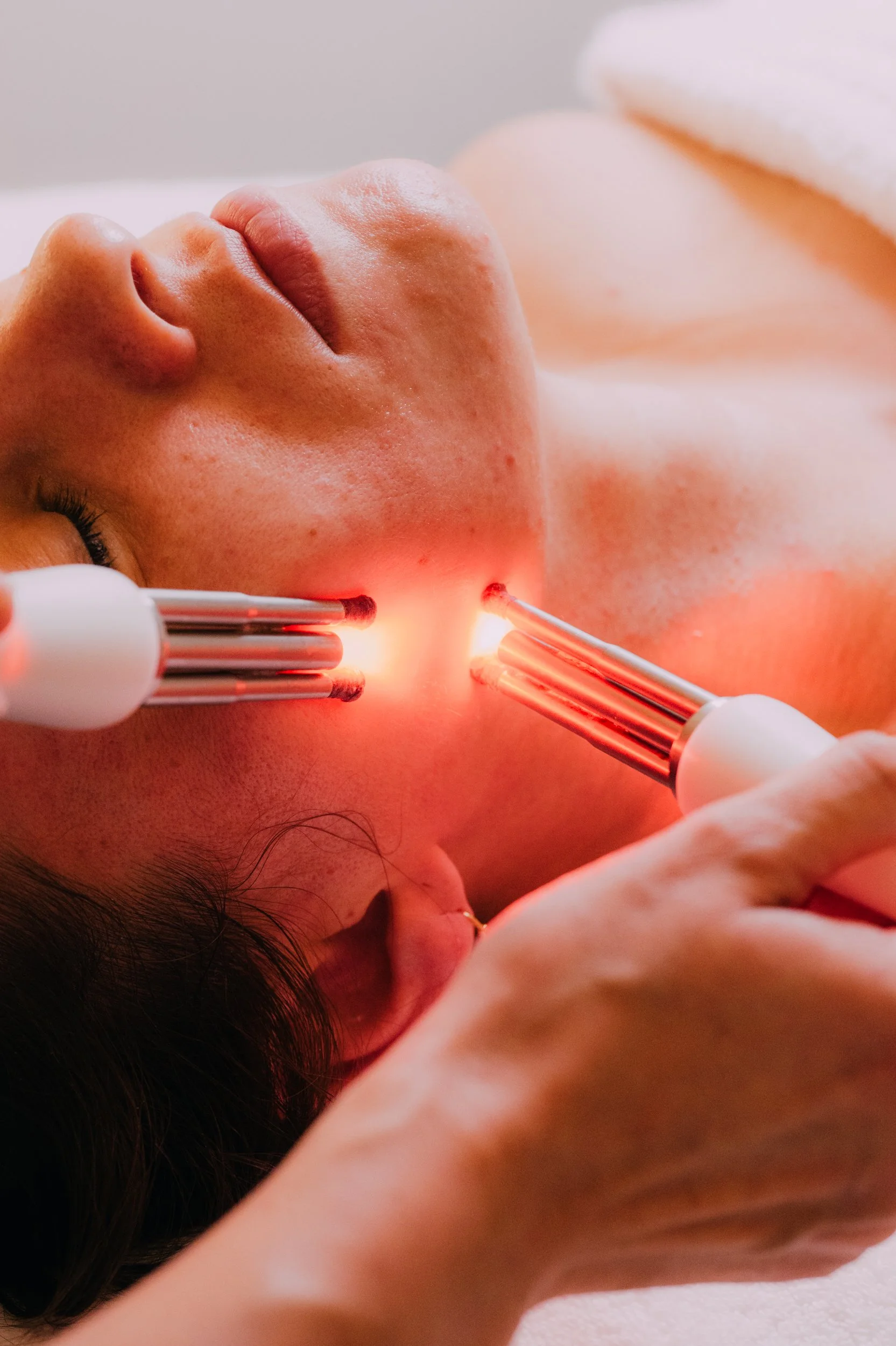 A person receiving a laser facial treatment with two devices emitting red light on their face, lying down with a towel near their shoulder.
