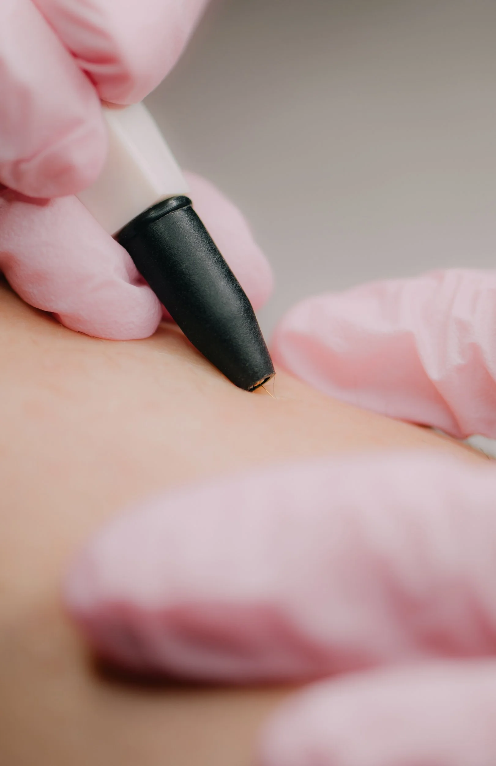 Close-up of a person getting a tattoo with a tattoo needle, wearing pink gloves.