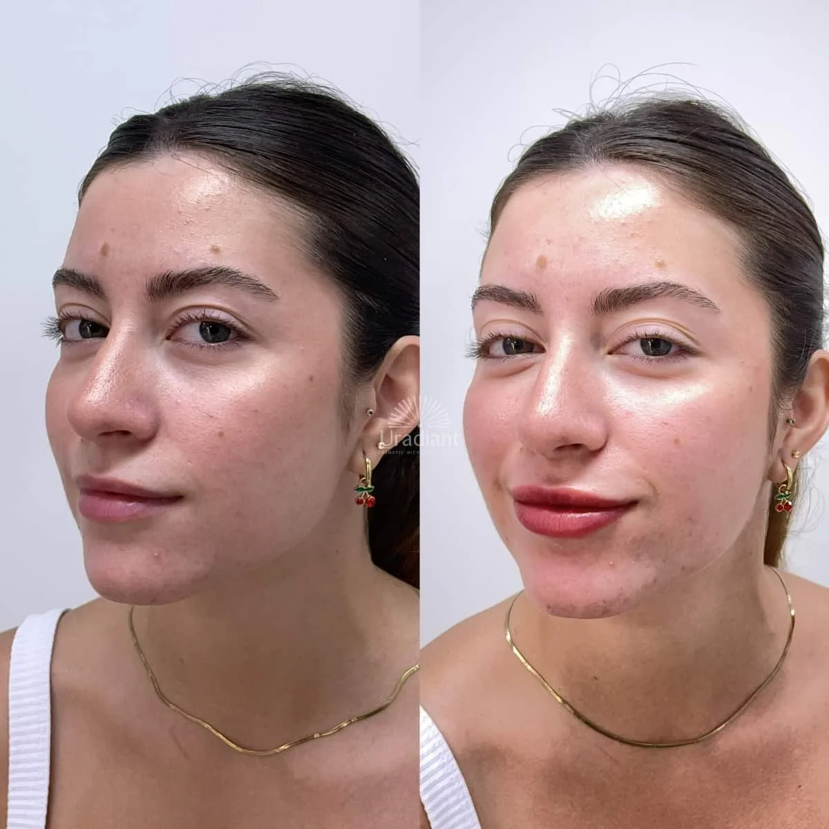 Borderless lip blush tattoo for a natural pillowy soft finish and seamless color blend at URADIANT Sydney.