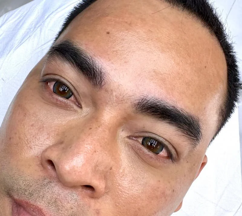 Precision nano machine strokes mimicking natural men's brow at URADIANT Sydney