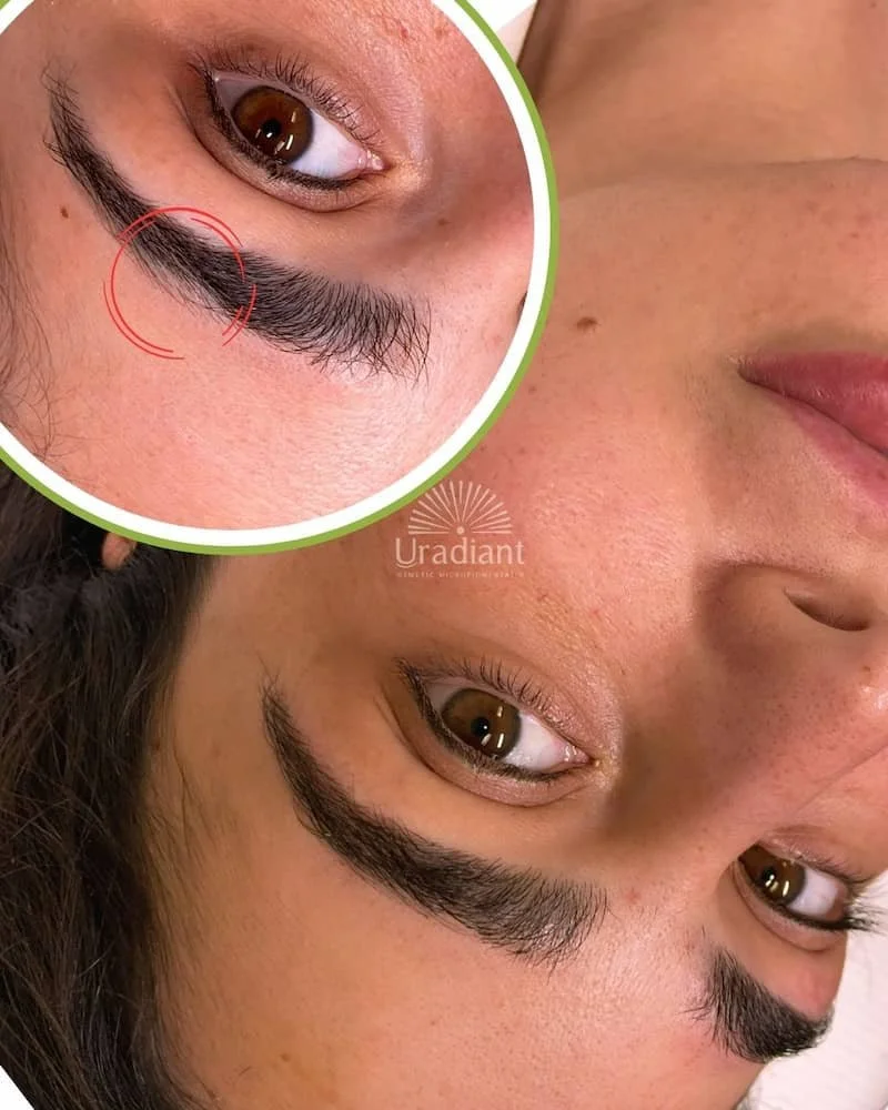 Do Eyebrow Tattoos Cause Hair Loss? A Clinical Perspective on Follicular Safety