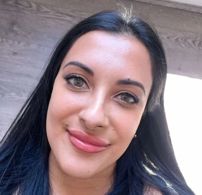 Glossy Dark Lip Neutralisation to correct hyperpigmentation and melanin and URADIANT Sydney