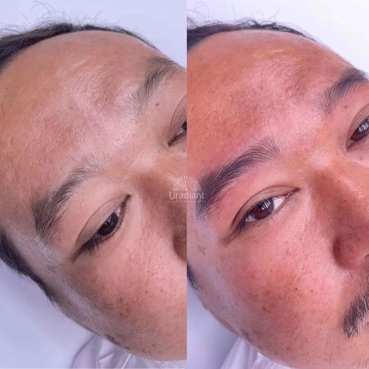 Enhanced Masculinity and Facial Structure with nano brows for latino men.