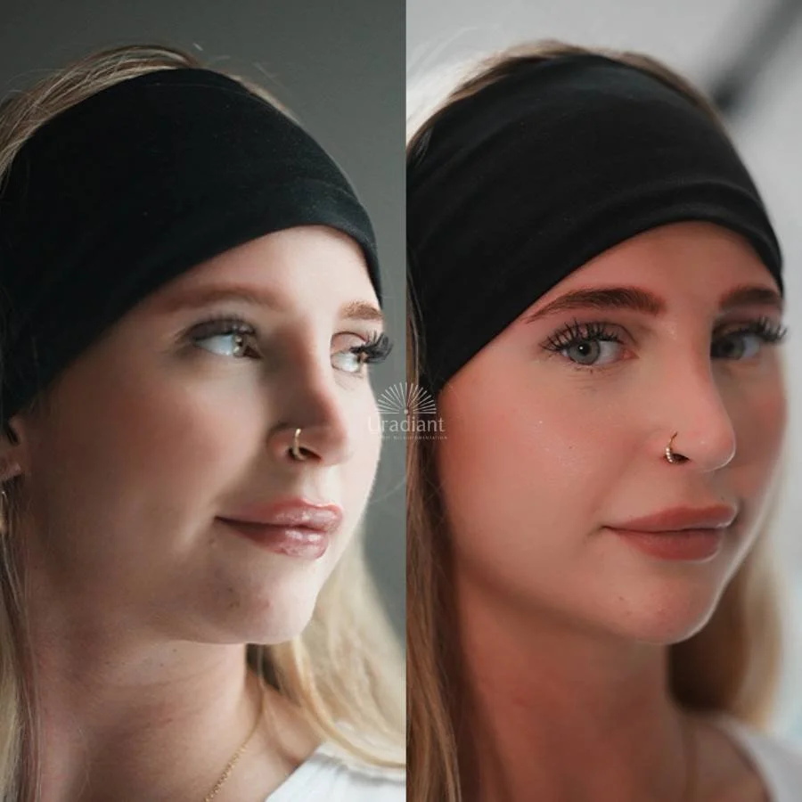 Colour Correction Nano Brows Sydney by Athera Tay: old tattoo neutralisation at URADIANT Paddington.