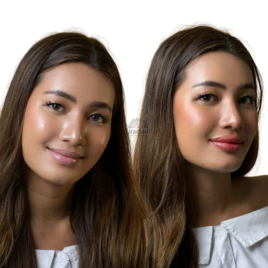 Dark lip neutralisation to correct dark lips - a cosmetic tattoo result in paddington studio