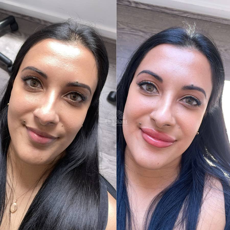 Lip neutralisation and colour correction for dark lips to achieve a bright warm coral finish.