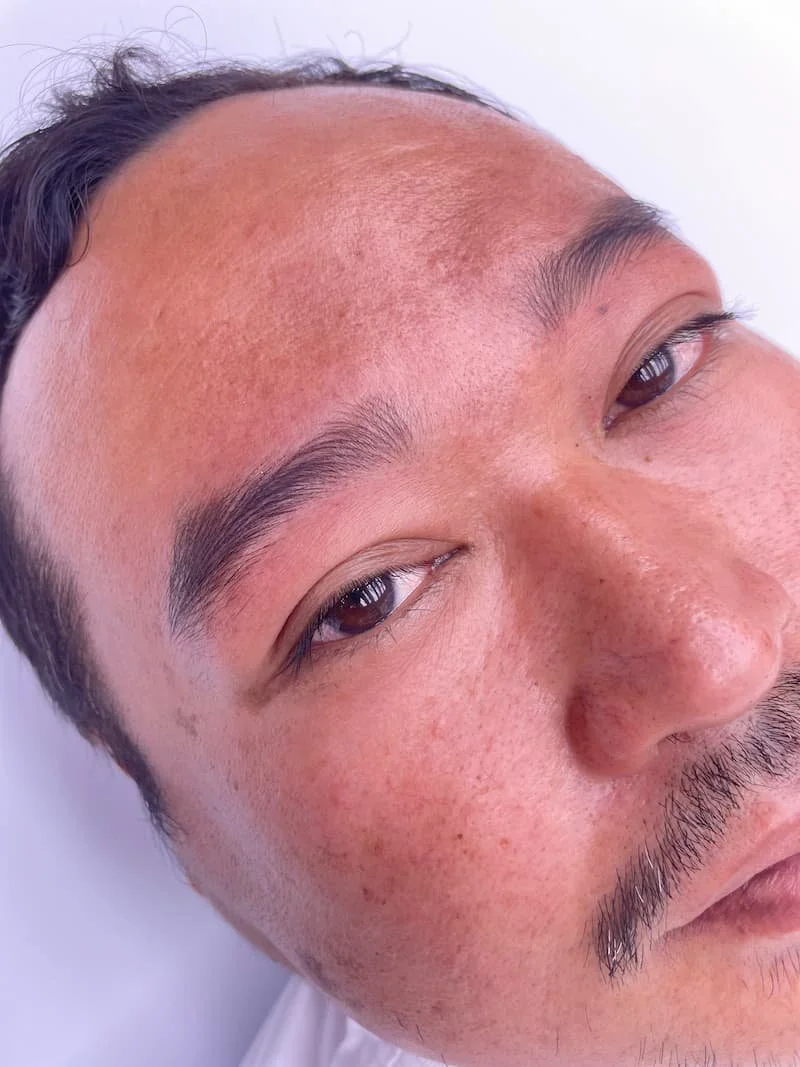 Enhanced Masculinity and Facial Structure with nano brows for latino men at URADIANT Paddington