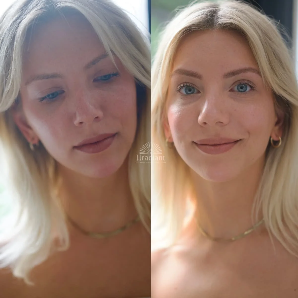 Custom blonde hybrid pigment for nano brows that healed without colour shift to red or grey in Paddington brow tattoo salon