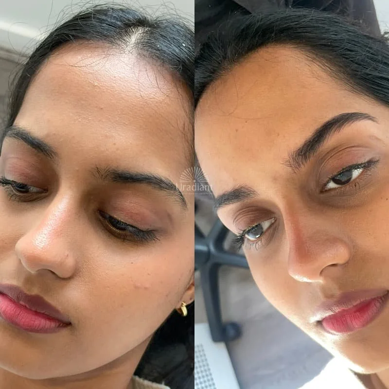 Delicate nano hairstorkes that blend seamless into brow hair at URADIANT Sydney, the best brow tattoo in Sydney. 