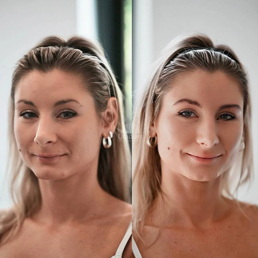 3D Brow Reconstruction Sydney: Hyper-real Nano Brows for over-plucked eyebrows by Athera Tay Paddington.