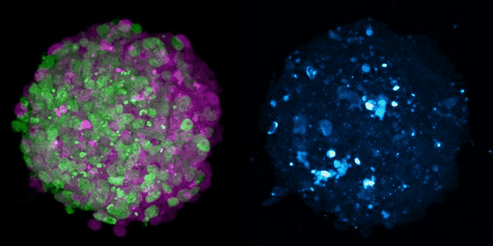 3D rendering of confocal microscopy view of a 3D mouse gastruloid at 72h after aggregation. Green and magenta cells in a mosaic gastruloid. cell competition, blue marks cleaved caspase 3 apoptosis, Joshua Frenster