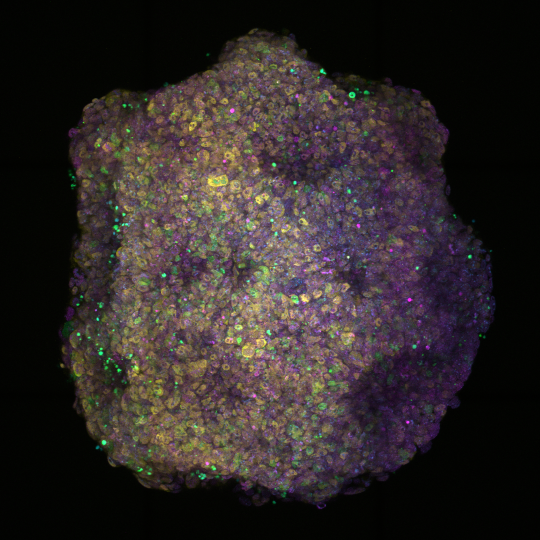 Confocal maximum intensity projection of p53-knockout 3D mouse gastruloid at 120h. Joshua Frenster