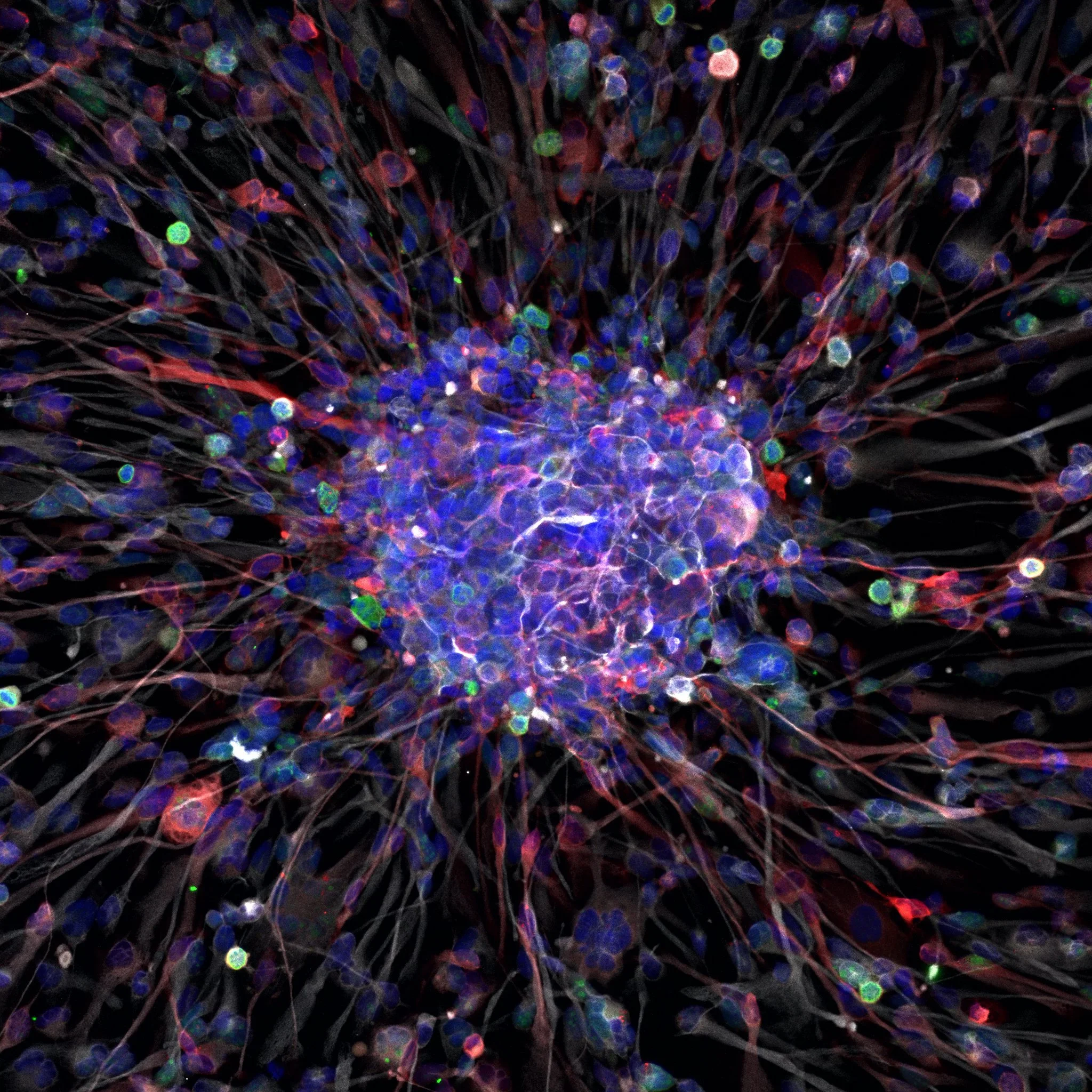 Microscopic view of numerous colorful cells or molecules clustered in the center with extending thin filaments against a black background. Joshua Frenster