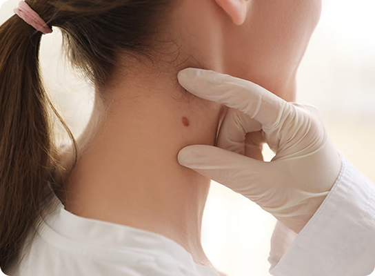 Skin Cancer Screening: When and Why You Should Get Checked