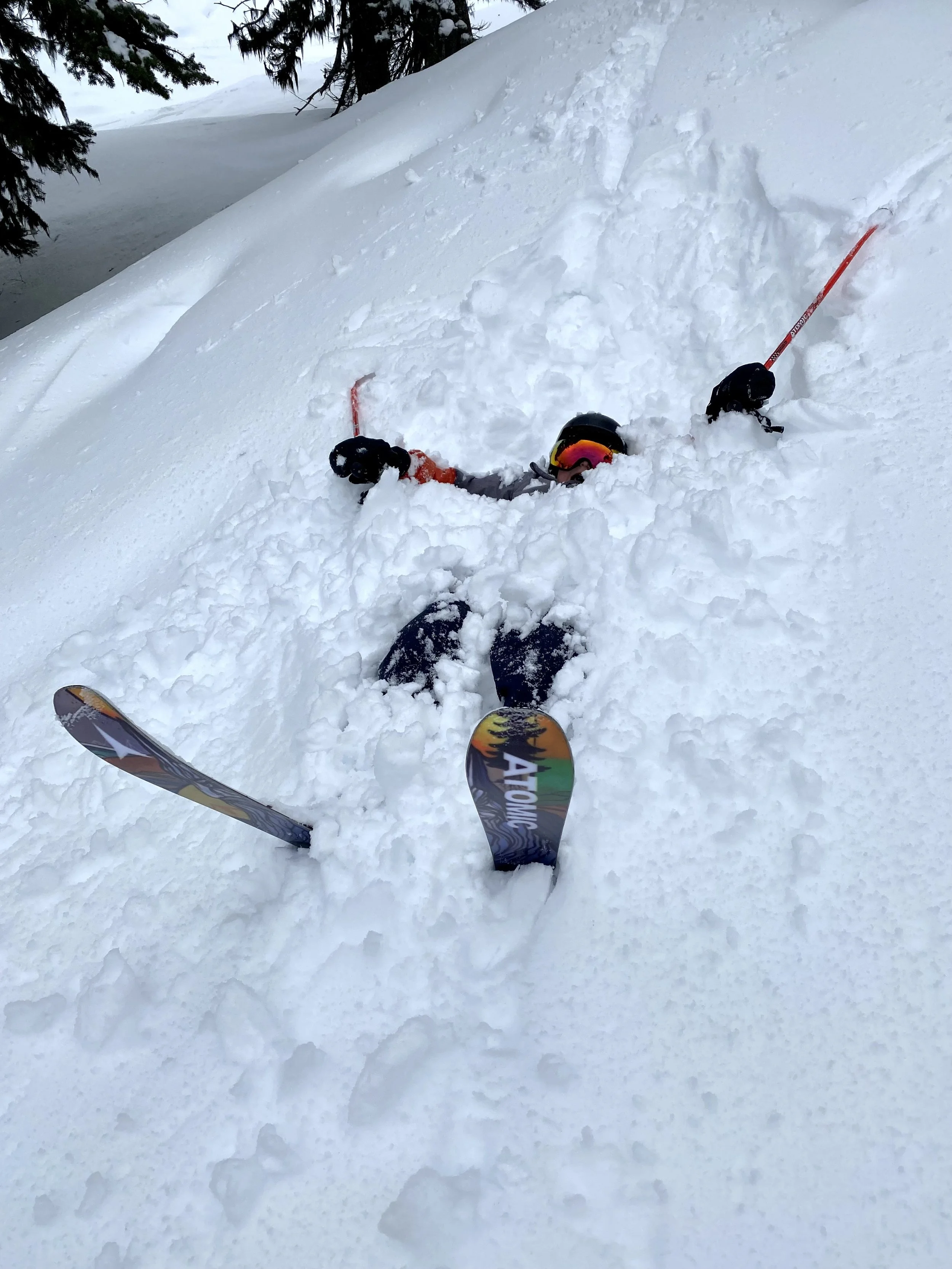 A person lying face down in deep snow while skiing, with ski poles and skis nearby, surrounded by a snowy landscape and trees.