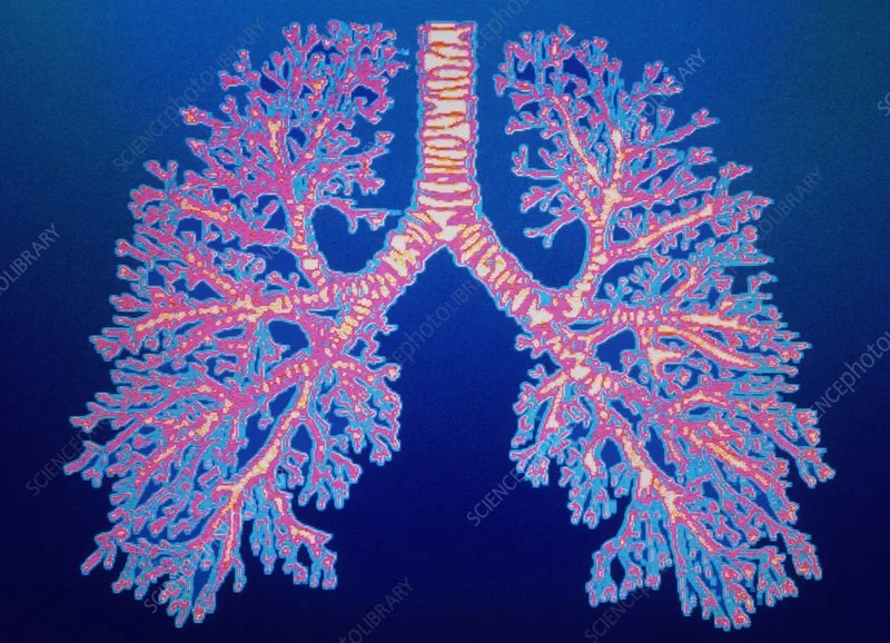 What is a Chest CT Scan?