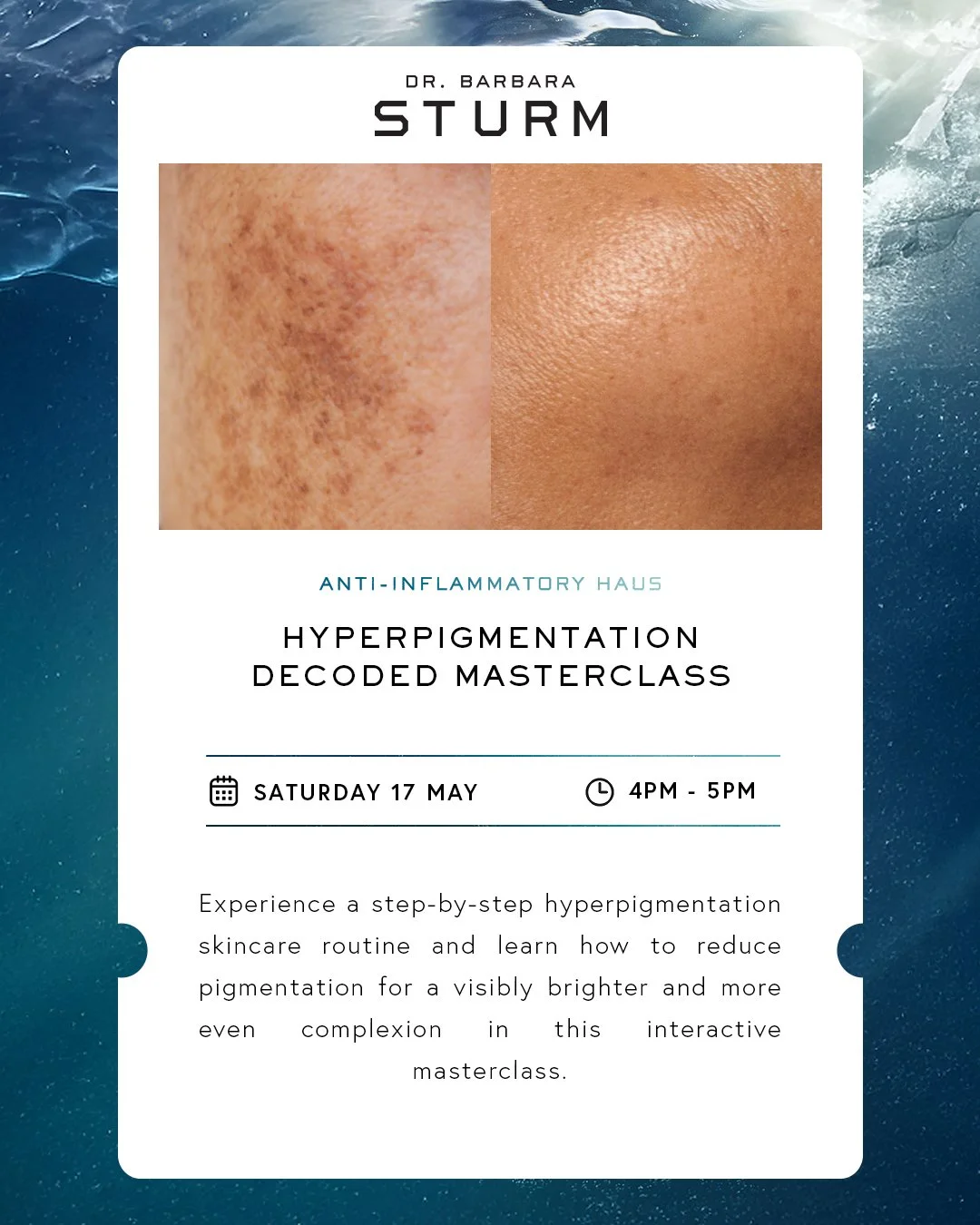 HYPER-PIGMENTATION DECODED MASTERCLASS.jpg