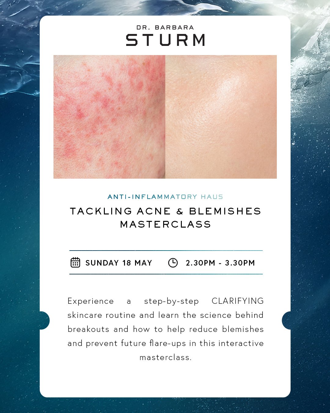 TACKLING ACNE & BLEMISHES MASTERCLASS.jpg