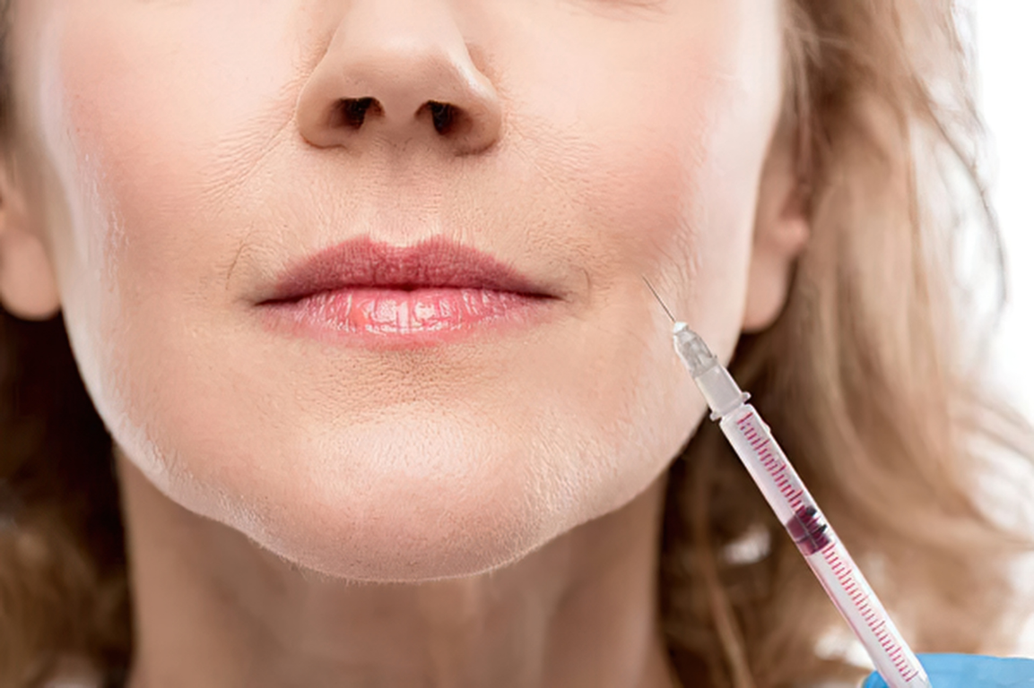 A woman is receiving a cosmetic injection near her lips from a syringe held by a medical professional.